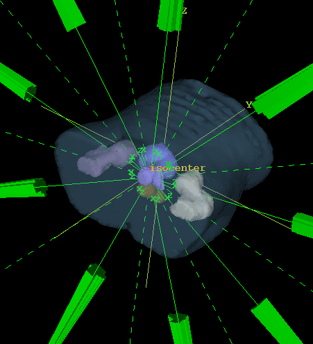 Radiation Treatment Planning Technologies